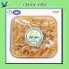 Chân Yến